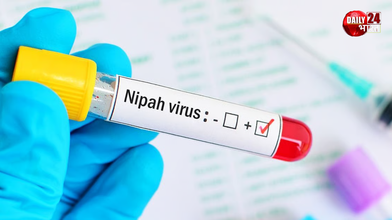 nipah virus
